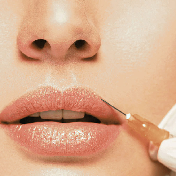 FILLERS