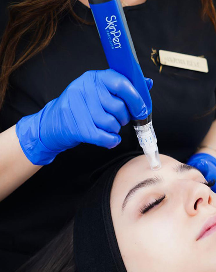 SKINPEN